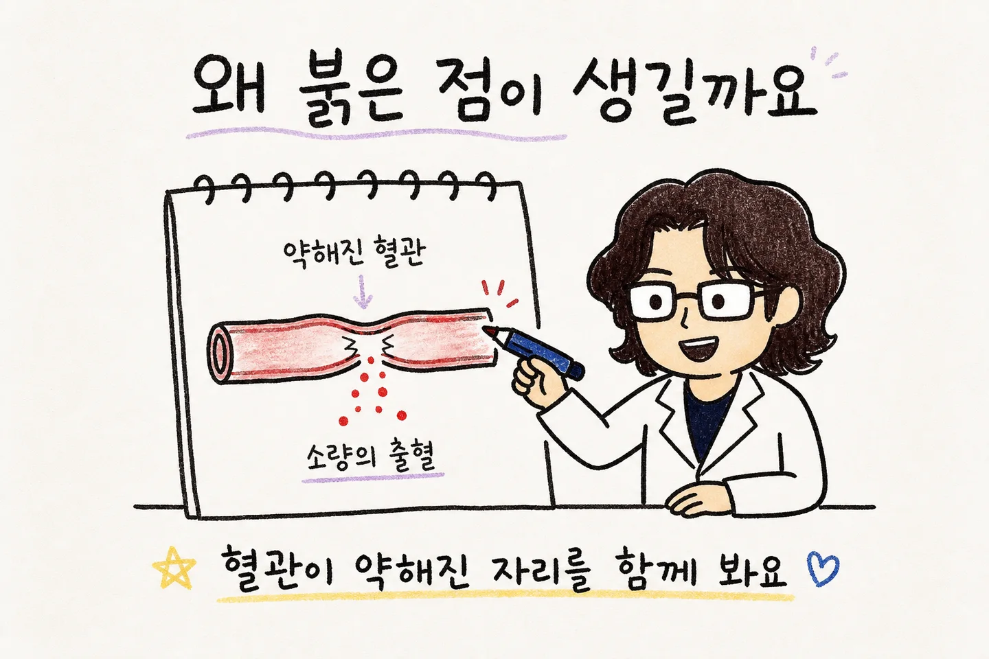 혈관이 약해져 피가 새는 구조를 노트에 설명하는 원장