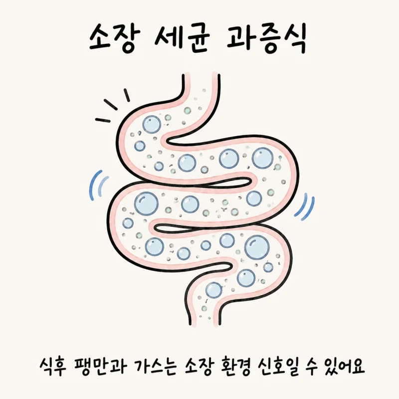 인천 송도 소장 세균 과증식 · 소장내 균 교대증 · 장내 세균 불균형 · SIBO