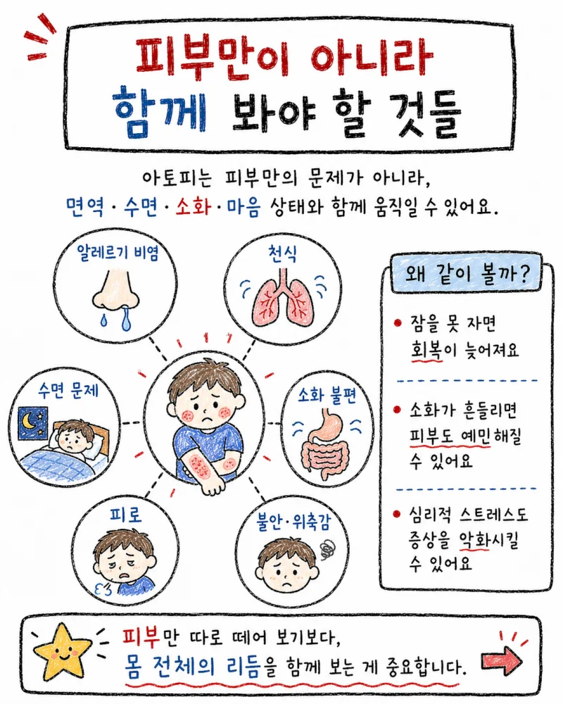 아토피 피부염의 주요 증상