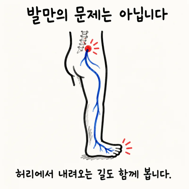 발저림이란?