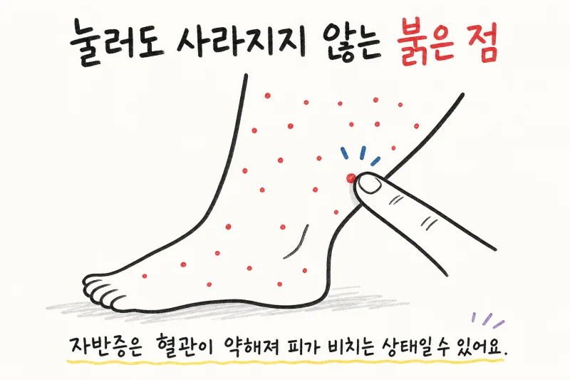 시흥 배곧신도시 자반증 · 다리 붉은 반점