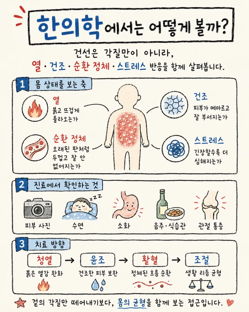 건선 치료 단계별 경과
