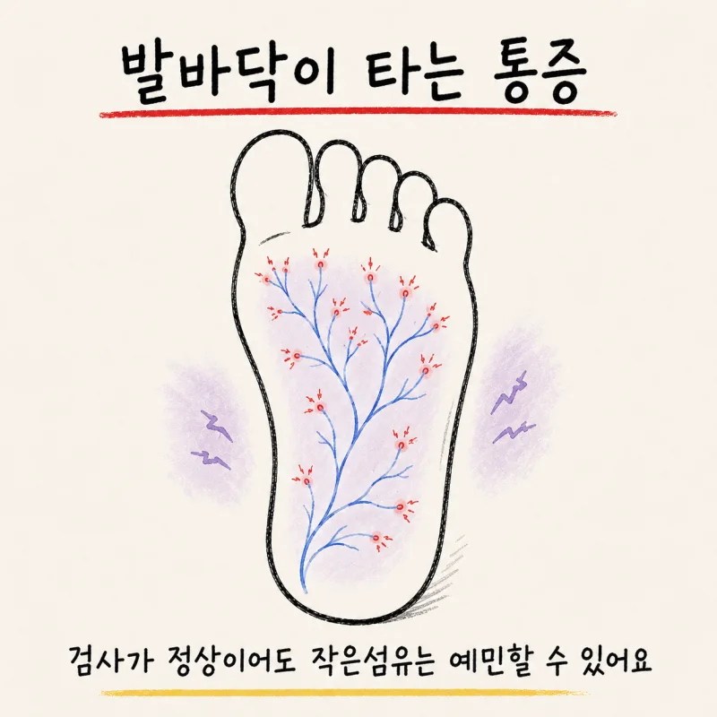 인천 송도 작은섬유 신경병증·소섬유 신경병증·말초신경병증