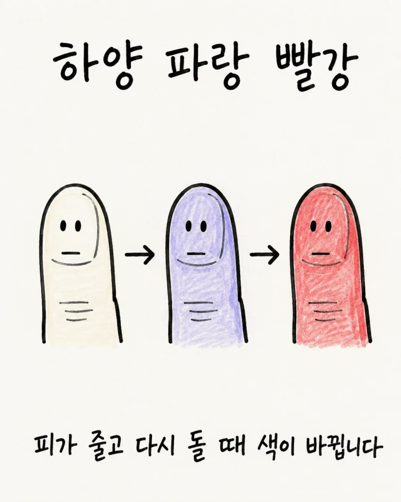 레이노증후군 주요 원인